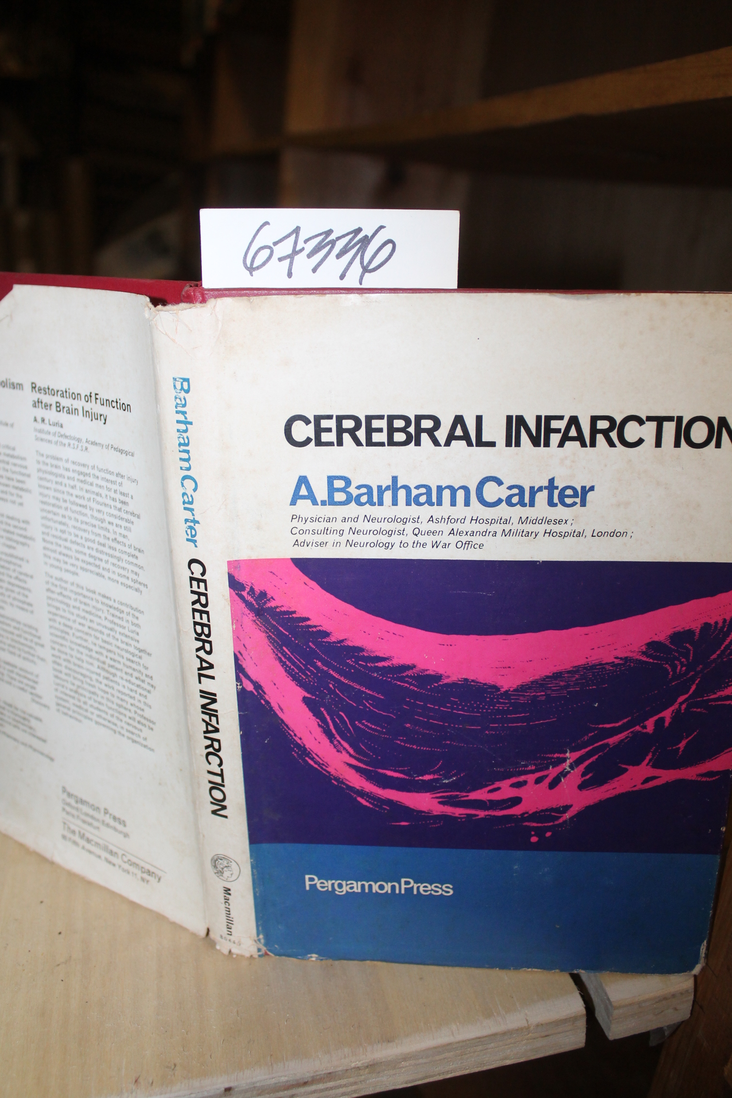 Carter, Alan Barham: Cerebral Infarction