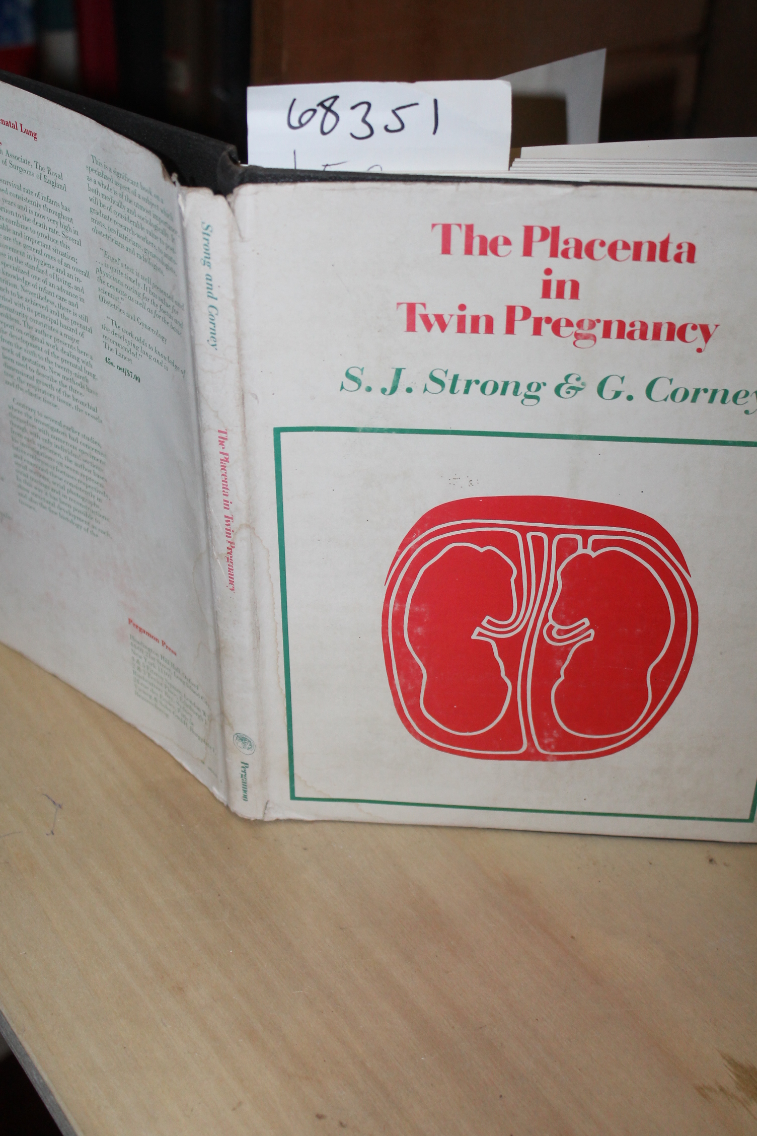 Strong, S. J. & Corney, G.: The Placenta in Twin Pregnancy